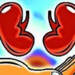 Hospitals told to make public their kidney transplant success rate